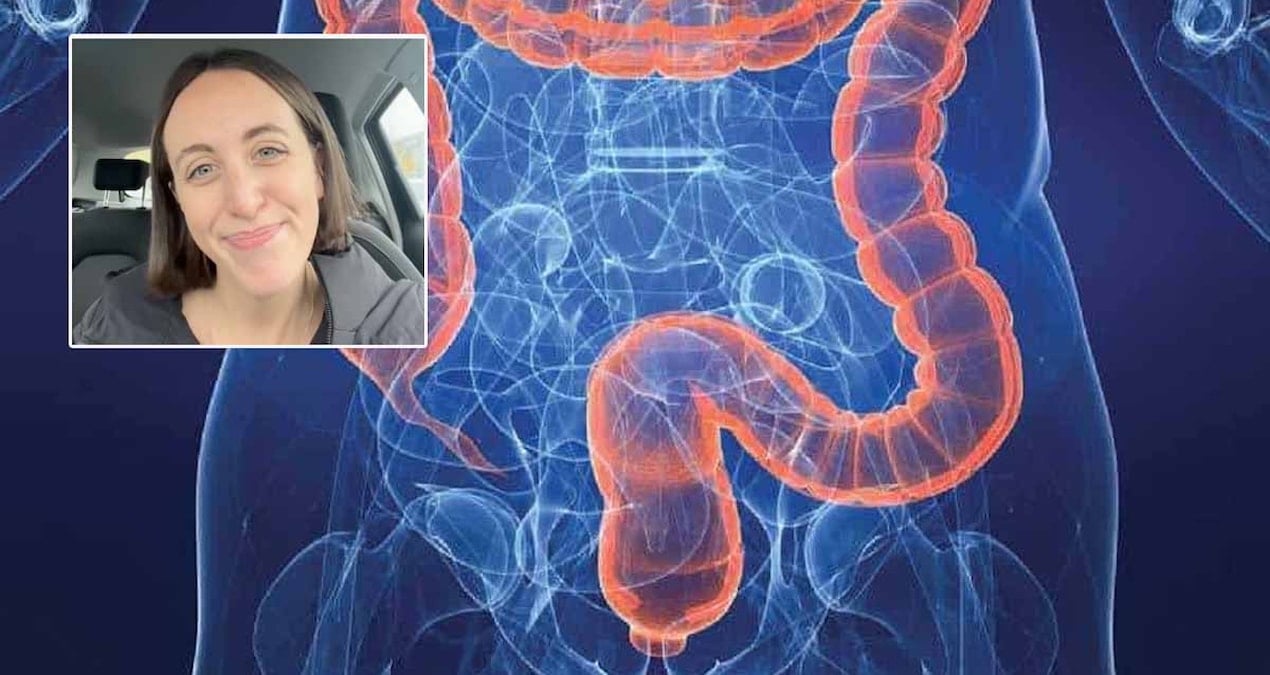 henuz 25 yasinda kolon kanserine yakalandi bana olmaz demeyin diyerek kendisinde gordugu 4 belirtiyi siraladi 2r4G94HZ